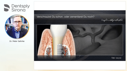 Dentsply Sirona Implants Webinar: Langfristig exzellente Frontzahnästhetik