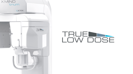 X-MIND Trium True Low Dose