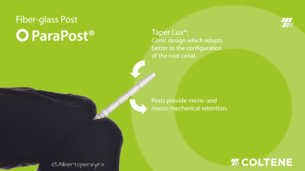 ParaPost– Der am häufigsten verwendete Wurzelstift in der Zahnmedizin