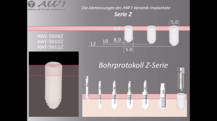 Bohrprotokoll zur AWI Implantat Z-Serie
