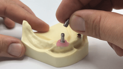 TRI® 2in1 Impression Abutment Tutorial