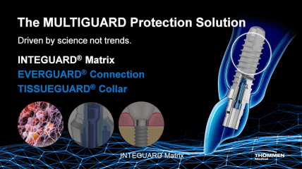 Multiguard Protection -  Solution 1