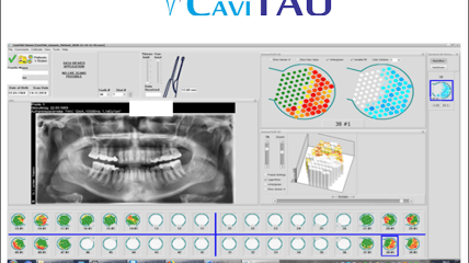 CaviTAU Trailer