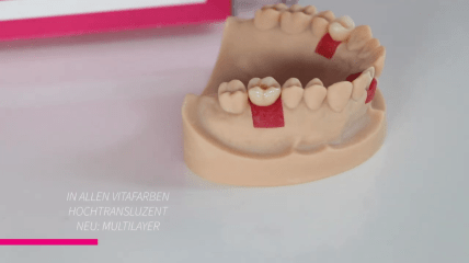 Individuelle Lösungen mit Zeramex Digital Solutions