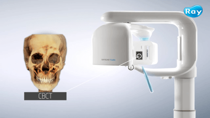 RAYSCAN Studio – Eine neue Ära digitaler Bildgebung