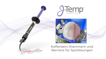 Anwendung des provisorischen Restaurationsmaterials J-Temp™
