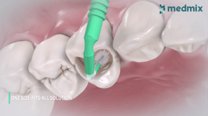 ZerofloX™ – Faserfreier Mikroapplikator für ästhetische Ergebnisse