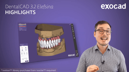 DentalCAD 3.2 Elefsina Highlights Video