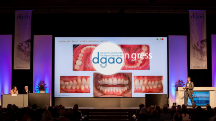 DGAO-Kongress blickt auf 25 Jahre Aligner Orthodontie