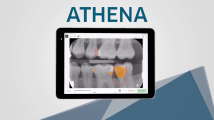 Athena - Digitale Aufklärung & Anamnese für Zahnarztpraxen