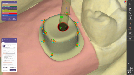 Neu bei Dental CAD 3.3: Abutment-Gesamtform über Kontrollpunkte drehen