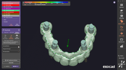 exocad DentalCAD 3.3 Chemnitz: Andere konfigurierbare Parameter