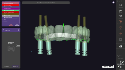 exocad DentalCAD 3.3 Chemnitz: Apply