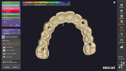 exocad DentalCAD 3.3 Chemnitz: Merged Parts