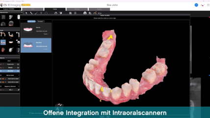 CS 3D Imaging Premium: Nutzen Sie die Leistungsfähigkeit der KI
